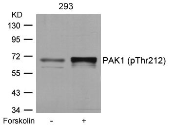 Anti-Phospho-PAK1 (Thr212) Polyclonal Antibody