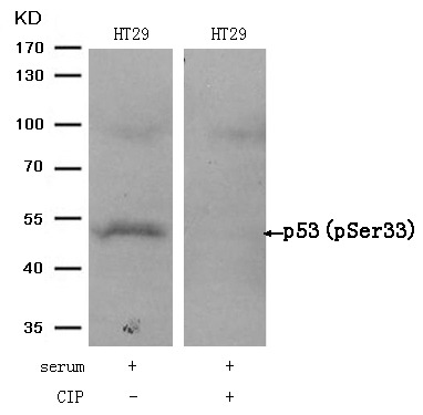Anti-Phospho-p53 (Ser33) Polyclonal Antibody