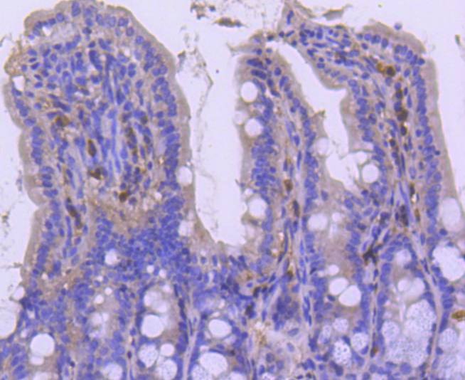 Anti-CDKN1B Antibody (9B660)