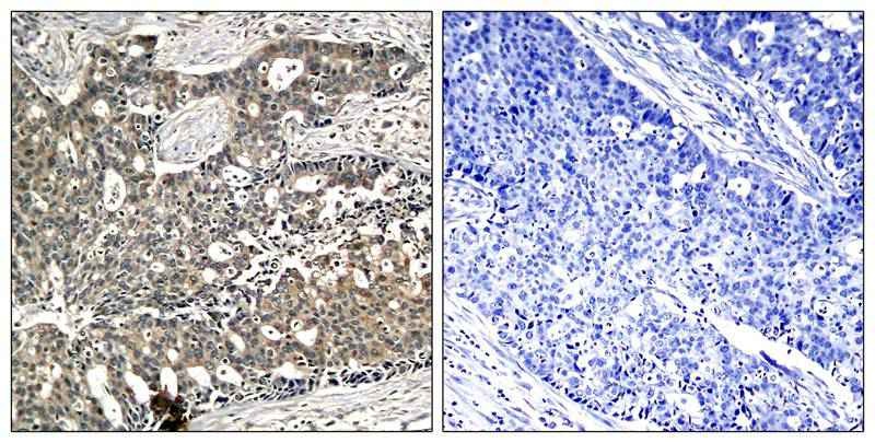 Anti-Phospho-p56 Dok-2 (Tyr299) Polyclonal Antibody