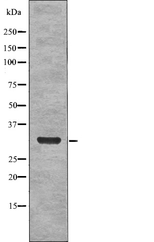 Anti-Phospho-NPM (Ser4) Polyclonal Antibody
