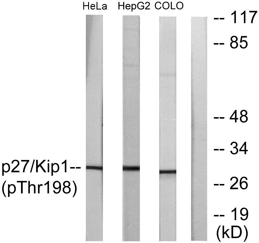 Anti-Phospho-CDKN1B (Thr198) Polyclonal Antibody