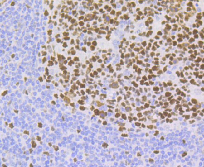 Anti-p60 CAF1 Antibody (4X99)