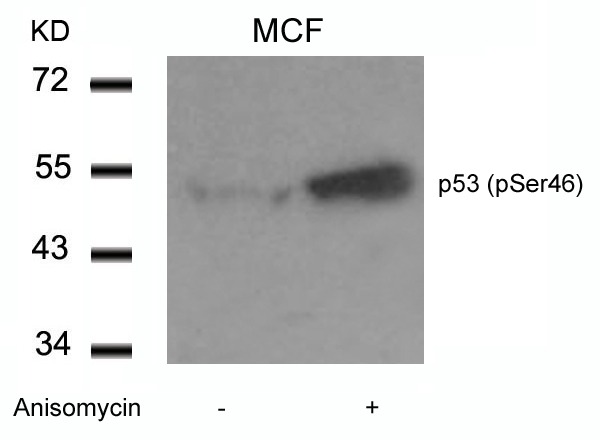 Anti-Phospho-p53 (Ser46) Polyclonal Antibody