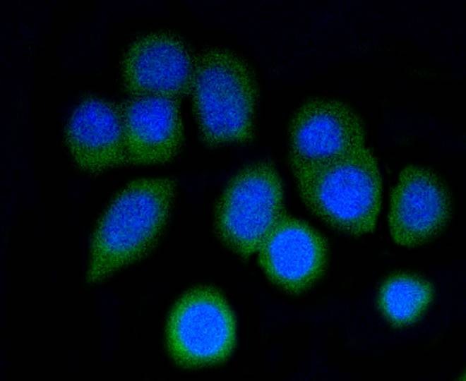 Anti-p16 ARC Antibody (3G504)
