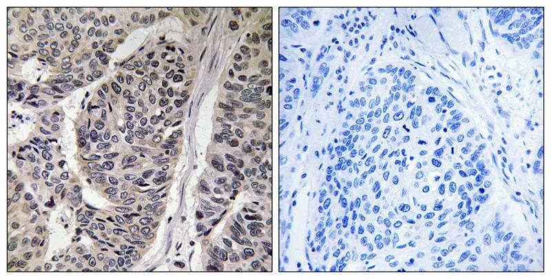 Anti-Phospho-p130 Cas (Tyr410) Polyclonal Antibody