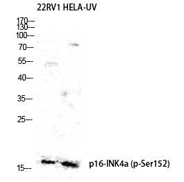 Anti-Phospho-p16 (Ser152) Polyclonal Antibody