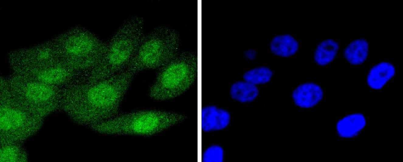 Anti-p16-INK4a Antibody (7Y998)