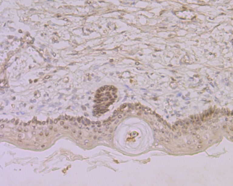 Anti-Nucleostemin Antibody (4J11)