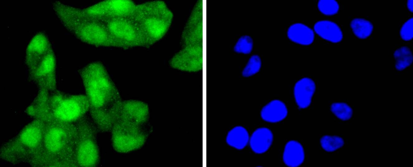 Anti-p16-INK4a Antibody (7Y998)
