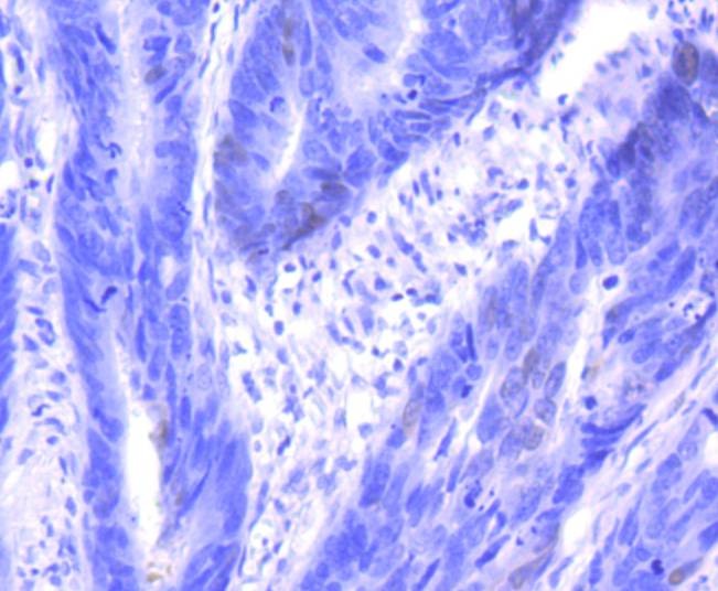 Anti-p16-INK4a Antibody (7Y998)