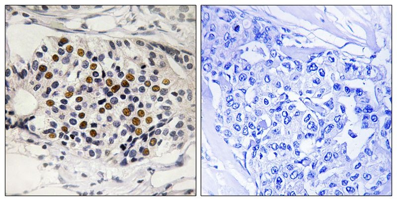 Anti-Phospho-p16-INK4a (Ser152) Polyclonal Antibody