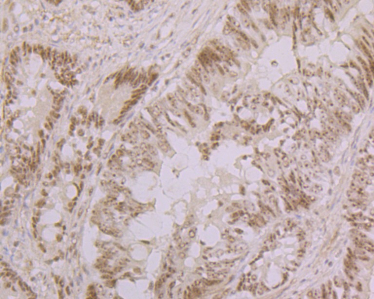 Anti-Nucleostemin Antibody (4J11)