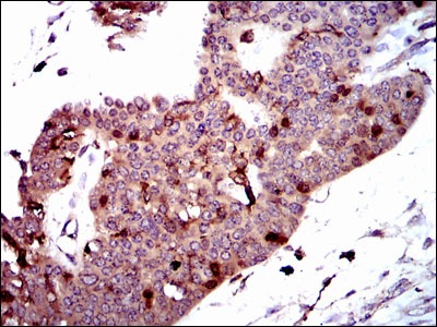 Anti-PBK/TOPK Antibody (6C84)