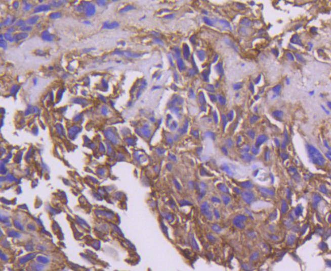 Anti-PDPK1 Antibody (6S392)
