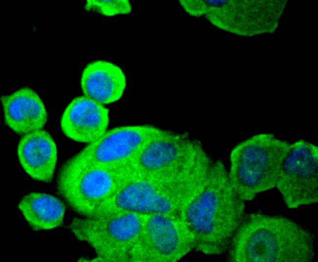 Anti-PDPK1 Antibody (6S392)