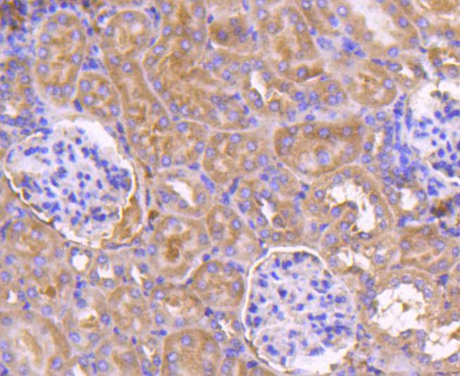 Anti-PDPK1 Antibody (6S392)