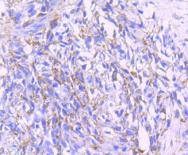 Anti-PDHA1 Antibody (9B780)