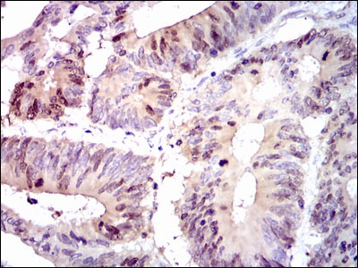 Anti-PBK/TOPK Antibody (6C84)