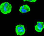 Anti-PDPK1 Antibody (6S392)