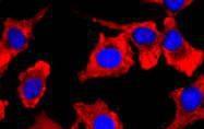 Anti-PDHA1 Antibody (9B780)