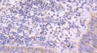 Anti-PDHA1 Antibody (9B780)