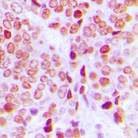 Anti-Phospho-PE2 (Thr526) Polyclonal Antibody