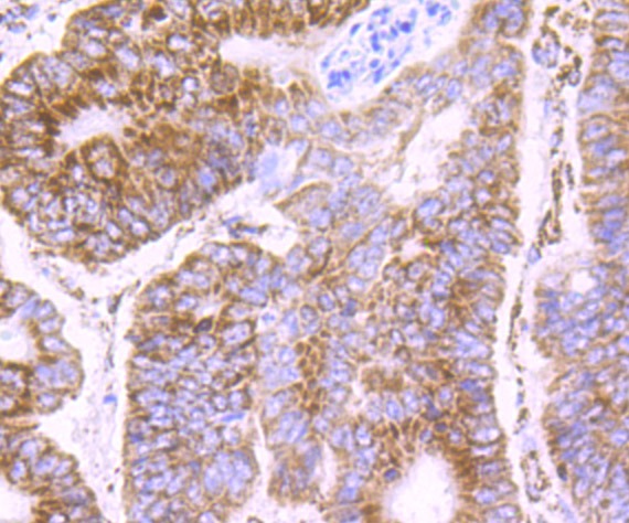 Anti-PDK2 Antibody (1C819)