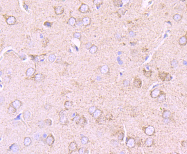 Anti-PDK2 Antibody (1C819)