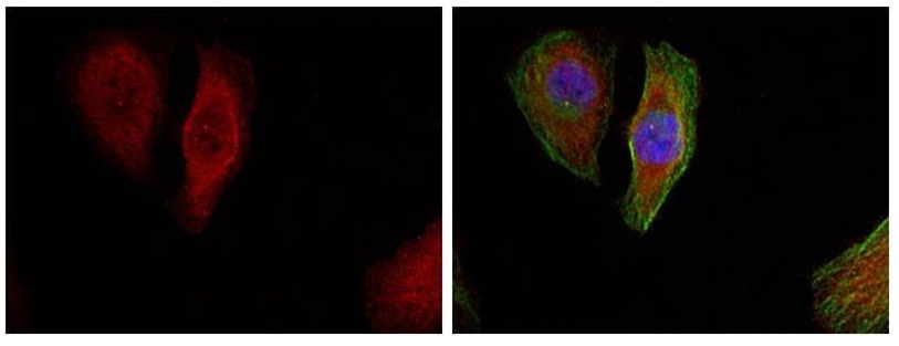 Anti-Phospho-MAPK3/ERK2 (Thr202) Polyclonal Antibody