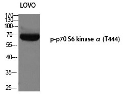 Anti-Phospho-S6K1/RPS6KB1 (Thr444) Polyclonal Antibody
