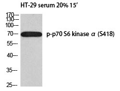 Anti-Phospho-S6K1/RPS6KB1 (Ser418) Polyclonal Antibody