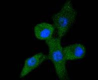 Anti-Acetyl-p53 (Lys382) Antibody (4U203)