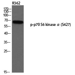 Anti-Phospho-S6K1/RPS6KB1 (Ser427) Polyclonal Antibody