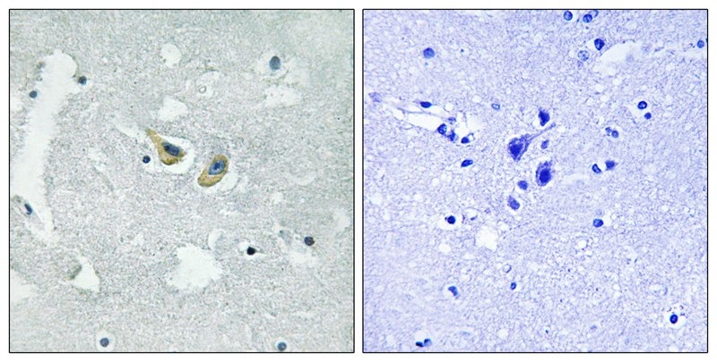 Anti-Phospho-NCF1 (Ser345) Polyclonal Antibody