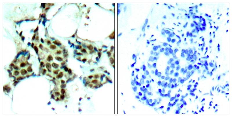 Anti-Phospho-MAPK14 (Tyr182) Polyclonal Antibody