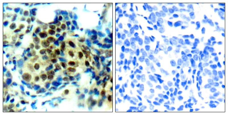 Anti-Phospho-MAPK3/ERK2 (Thr202) Polyclonal Antibody