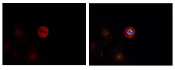 Anti-Phospho-MAPK3/ERK2 (Tyr204) Polyclonal Antibody