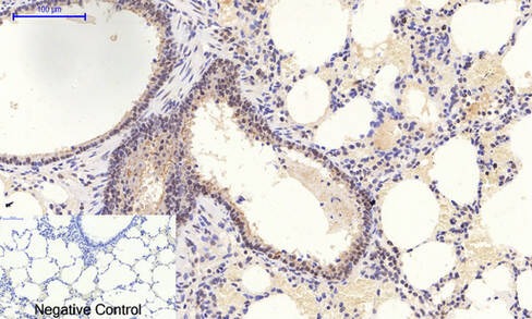 Anti-Phospho-MAPK14 (Thr180, 182) Polyclonal Antibody