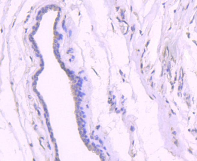Anti-Acetyl-p53 (Lys382) Antibody (4U203)
