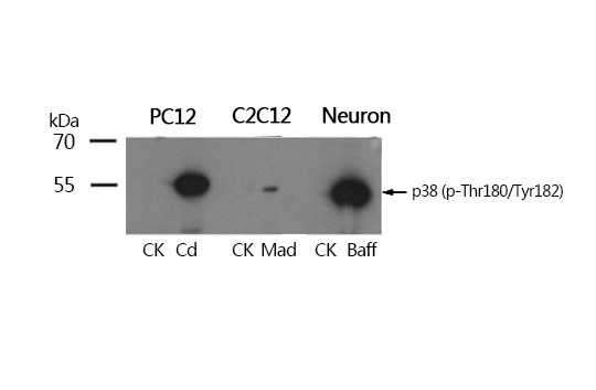 Anti-Phospho-MAPK14 (Thr180, 182) Polyclonal Antibody