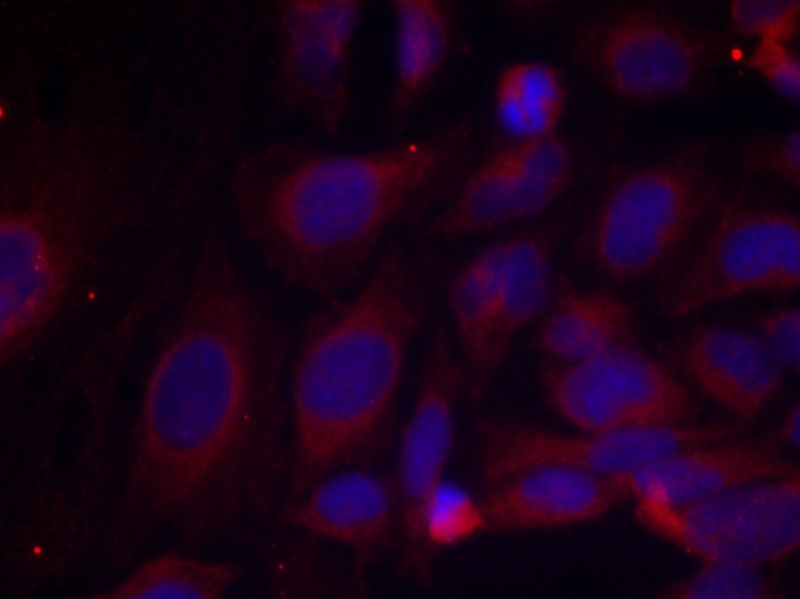 Anti-Phospho-NFKB1 (Ser893) Polyclonal Antibody