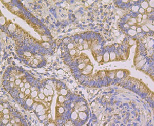 Anti-NDUFS4 Antibody (3X649)