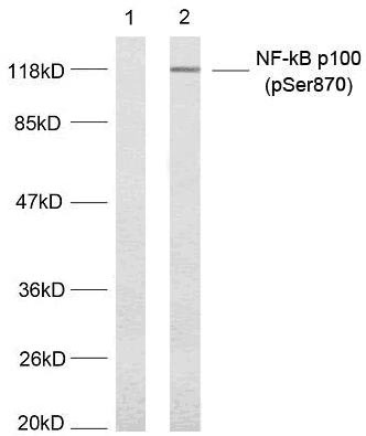 Anti-Phospho-NFkB p100 (Ser870) Polyclonal Antibody