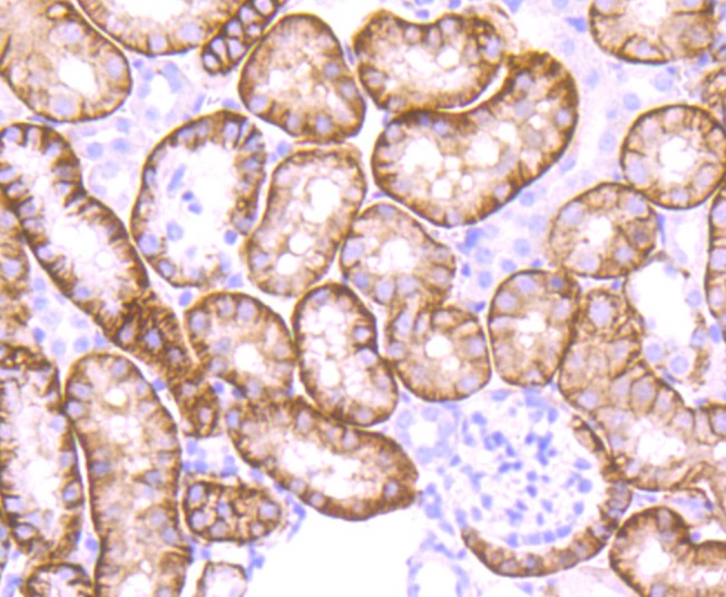 Anti-NDRG1 Antibody (7H760)