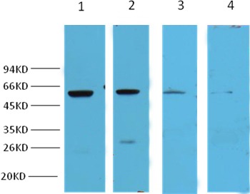 Anti-NF-kB p65 Antibody (9K999)