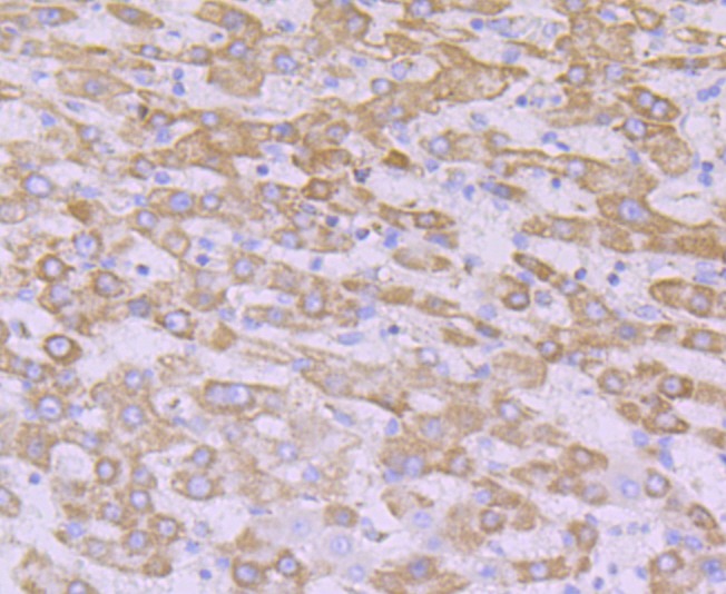 Anti-NDUFB8 Antibody (3W868)