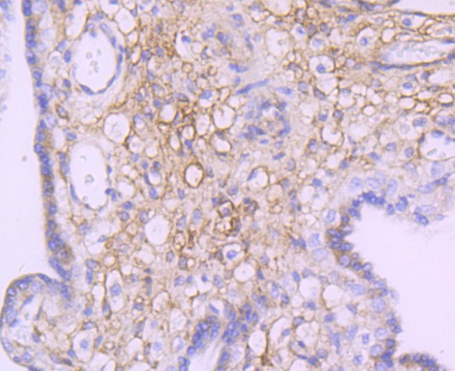 Anti-NDRG1 Antibody (7H760)