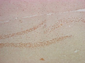 Anti-NF-kB p65 Antibody (9K999)