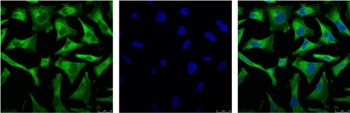 Anti-NF-kB p65 Antibody (9P885)